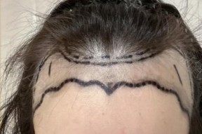 手机软件修发际线效果好吗？
